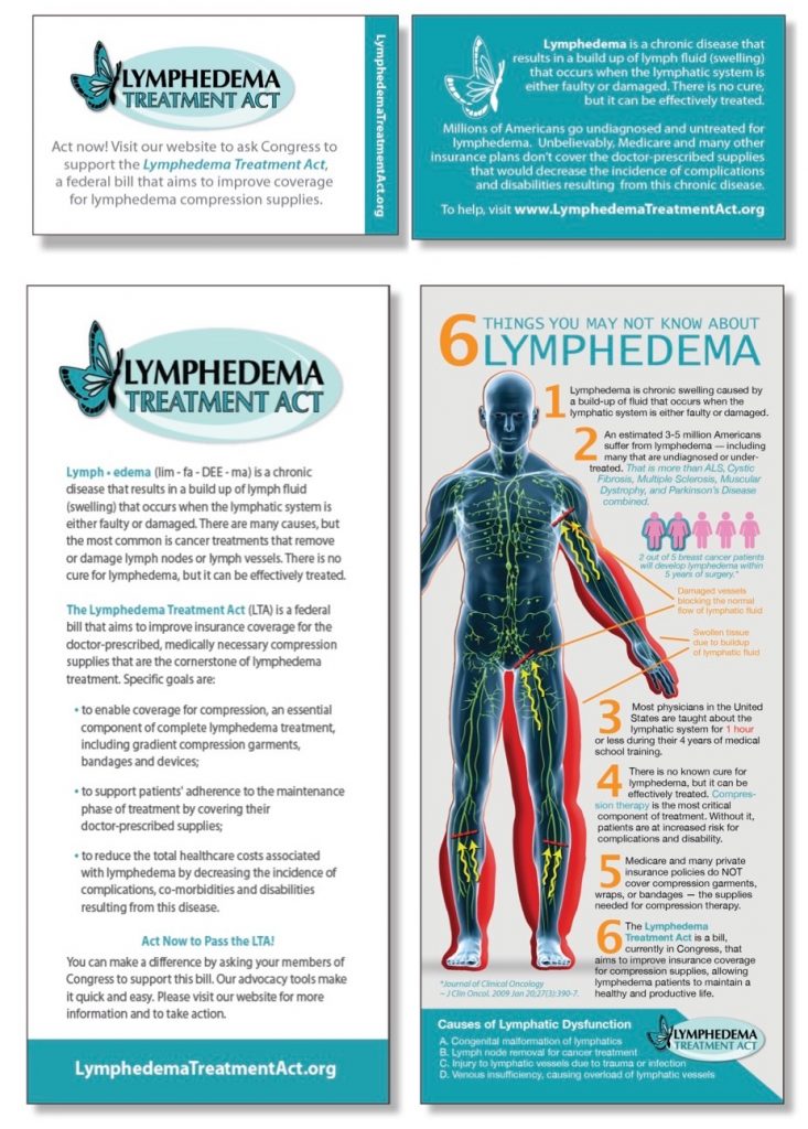 The Lymphedema Treatment Act(LTA)